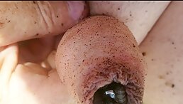 Maggots eating my dick